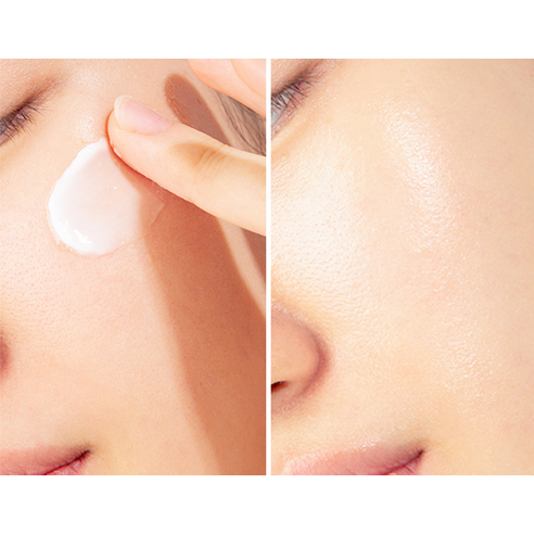 [SKU_5N7RMD_3IXKZWJ] Paparecipe Blemish Cream